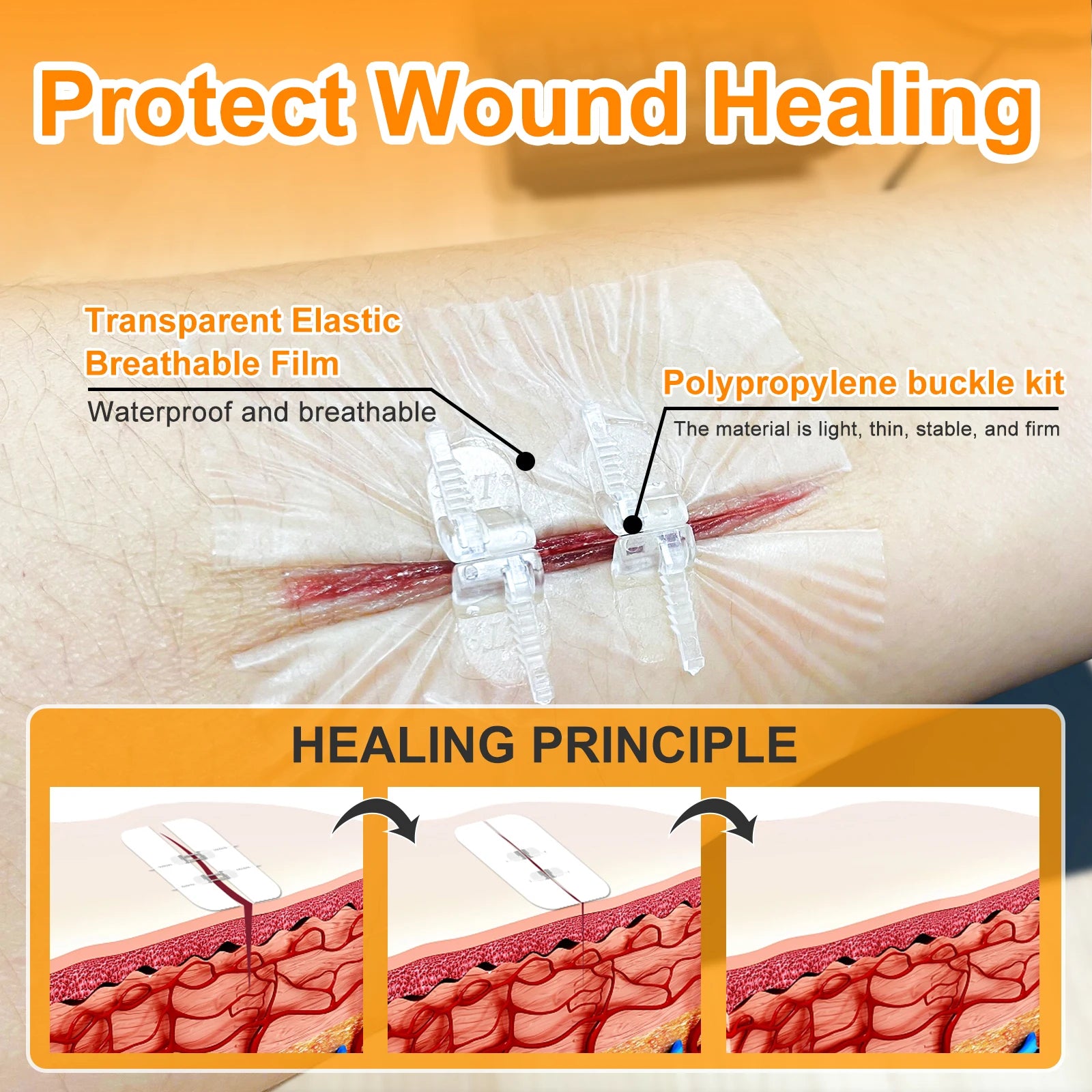 CARBOU 2PCS Painless Wound Closure Device Suture-Free Wound Dressing Closure Strips Zipper Kit Emergency Laceration Closures